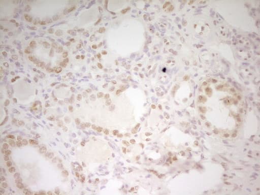 HMG20A Antibody (aa1-281, clone OTI5E3, Carrier-free)