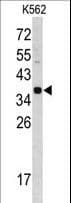CTSE / Cathepsin E Antibody (aa157-187)