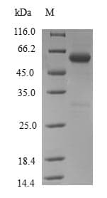 Human OSGEP Protein (Recombinant GST, N-terminus)