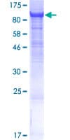 Human CNNM4 Protein (Recombinant GST)