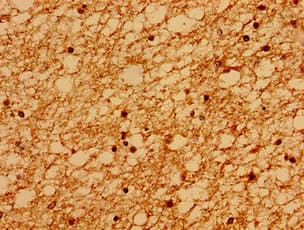Polyclonal Rabbit anti-Human SACS / Sacsin Antibody (IHC)