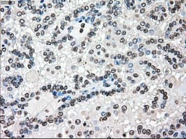 BRAF / B-Raf Antibody (clone OTI5A9)