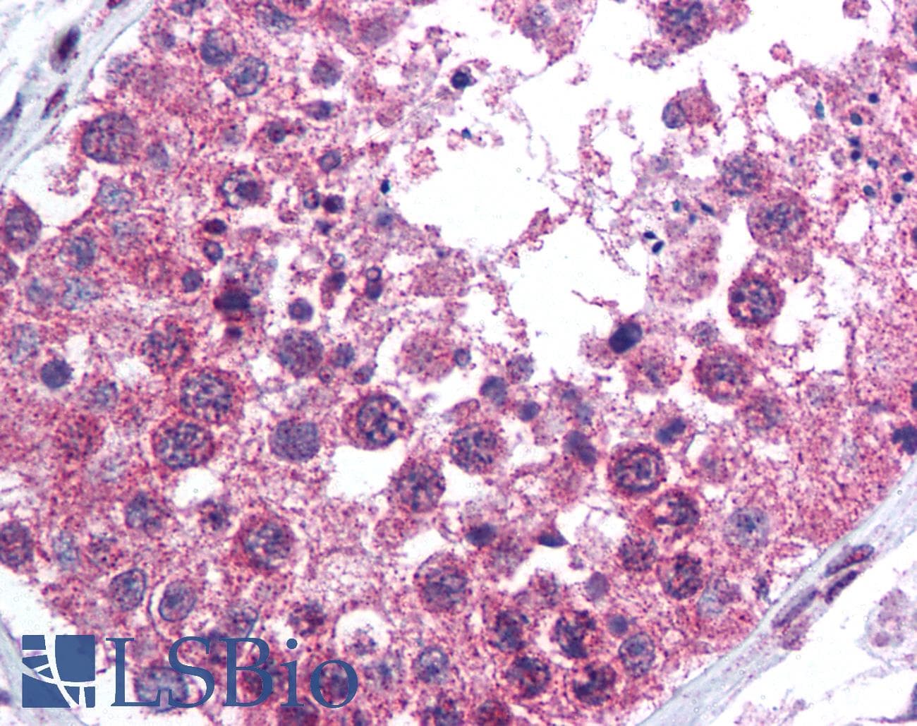IHC-plus™ KLK13 / Kallikrein 13 Antibody (aa262-277)