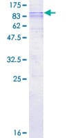 Human SLC33A1 Protein (Recombinant GST)
