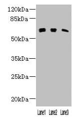 Polyclonal Rabbit anti-Human KLHL23 Antibody
