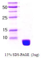 Human RPS27A Protein (Recombinant)