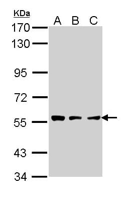 IHC-plus™ TPP1 / CLN2 Antibody (aa66-324)
