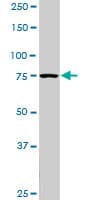 PIK3R1 / p85 Alpha Antibody (clone 3C11)