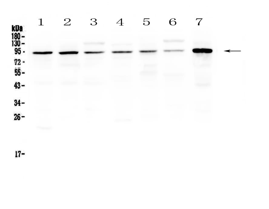 SAE2 / UBA2 Antibody