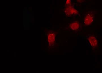 INTS2 / INT2 Antibody