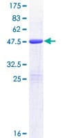 Human BAALC Protein (Recombinant GST)