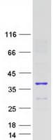 Human PID1 Protein (Recombinant Myc-DDK (Flag))