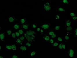 FGFR2 / FGF Receptor 2 Antibody (clone OTI1H5)
