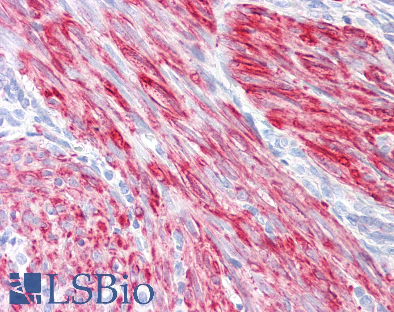 IHC-plus™ Polyclonal Rabbit anti-Human FLNA / Filamin A Antibody (aa2121-2170, IHC, WB)