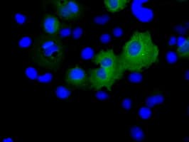 Monoclonal Mouse anti-Human RIP1 / RALBP1 Antibody (clone OTI2A6, IHC, IF, WB)
