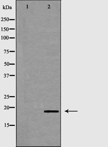 CD3D Antibody