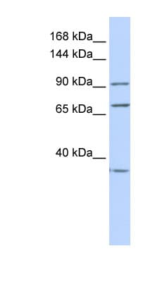 Polyclonal Rabbit anti-Human EEF2 / Elongation Factor 2 Antibody (aa36-85, IHC, WB)