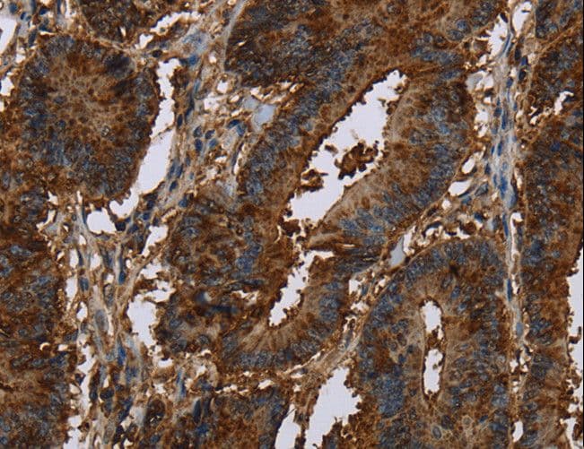 Polyclonal Rabbit anti-Human LASS5 Antibody (IHC)