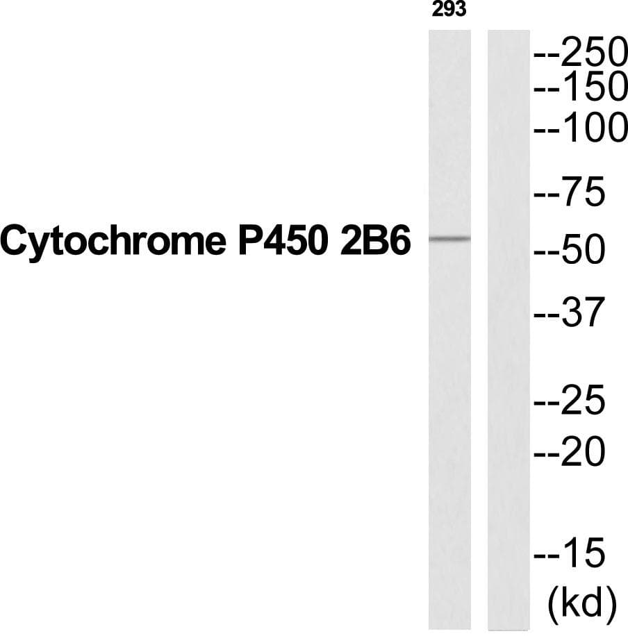 Polyclonal Rabbit anti-Human CYP2B6 Antibody (WB)