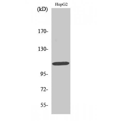 RB1 / Retinoblastoma / RB Antibody (720-800 aa)