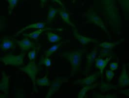 ACAT2 Antibody (clone OTI1C5)