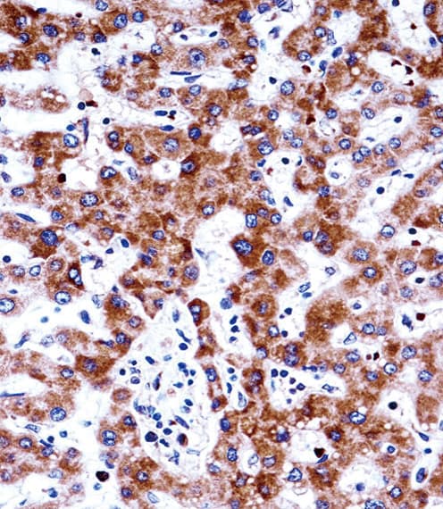 Polyclonal Rabbit anti-Human ADRA2C Antibody (aa354-382, IHC, WB)