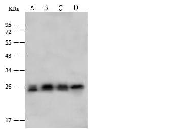 Polyclonal Rabbit anti-Human PSMA2 Antibody (IHC, WB)