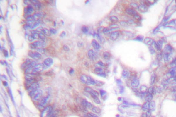 Polyclonal Rabbit anti-Human Vimentin Antibody (Ile444, IHC, IF, WB)