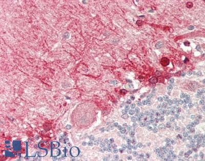 IHC-plus™ ADIPOR1/Adiponectin Receptor 1 Antibody
