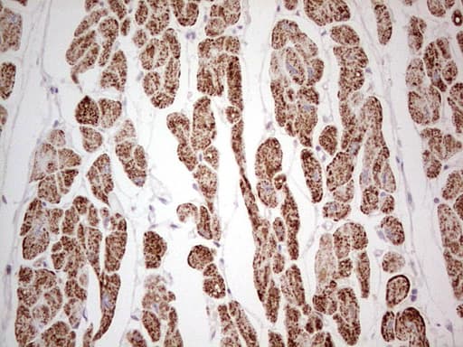 ANO1 / DOG1 / TMEM16A Antibody (aa1-333, clone OTI1H2)