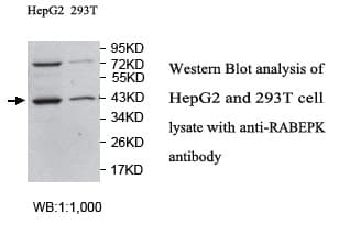 RABEPK / p40 Antibody (aa99-348)