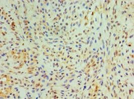 CST4 / Cystatin S Antibody (aa21-141)