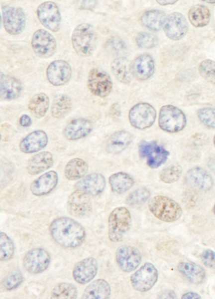 Geminin Antibody (aa160-C-term)