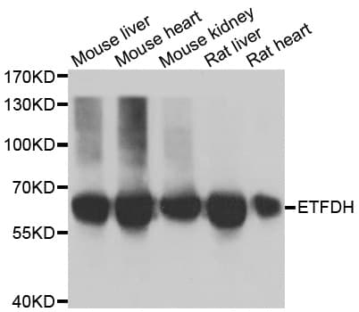ETFDH Antibody