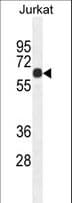 CCDC8 Antibody (aa390-418)