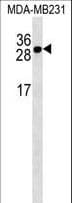 TNFRSF17 / BCMA Antibody (aa63-92)