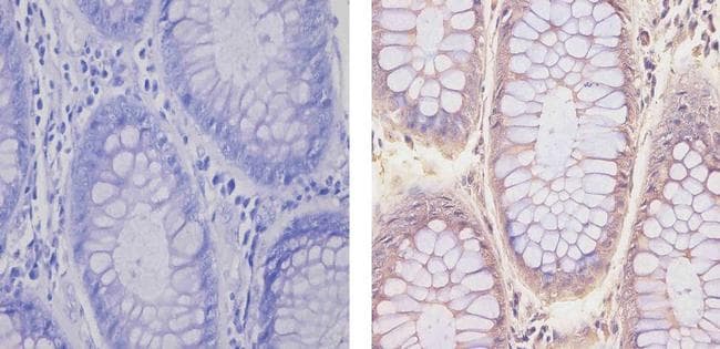 Monoclonal Mouse anti-Human NR3C1/Glucocorticoid Receptor Antibody (clone 6000000, IHC, IF, WB)