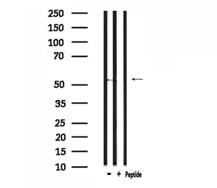 GPR37L1 Antibody