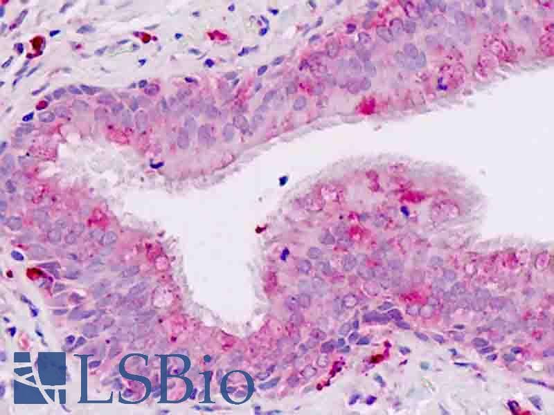 IHC-plus™ ACKR2 / CCR10 / D6 Antibody (aa335-384)