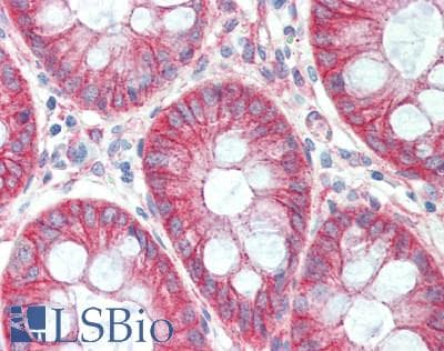 IHC-plus™ CTTN / Cortactin Antibody (aa450-500)