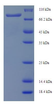 Human PLCD4 Protein (Recombinant His-SUMO)
