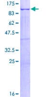 Human HLCS / HCS Protein (Recombinant GST)