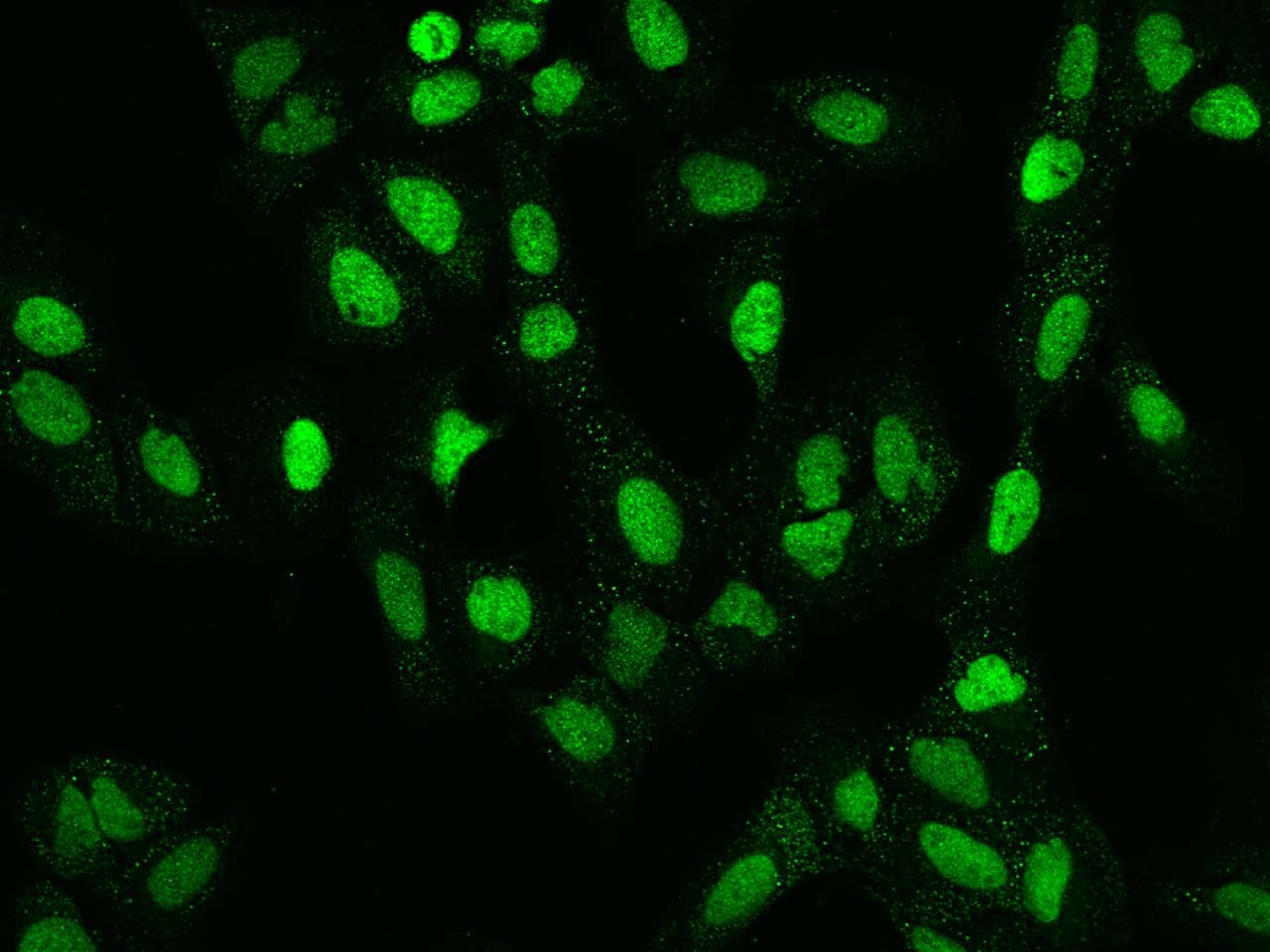 Polyclonal Rabbit anti-Human RNMT / HCM Antibody (IF, WB)