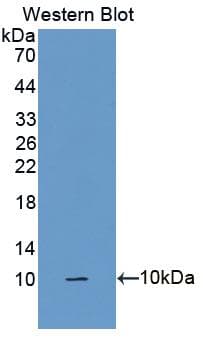 SFTPA2 / Surfactant Protein A2 Antibody (aa20-78, Biotin)