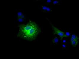 CD80 Antibody (clone OTI6H7)