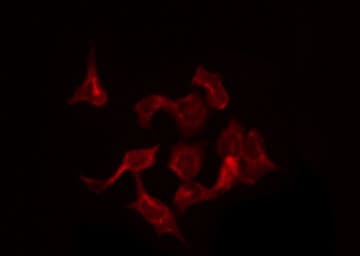 SLC30A1 / ZNT1 Antibody
