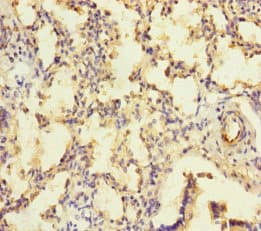 Polyclonal Rabbit anti-Human KIZ / PLK1S1 Antibody (IHC, WB)