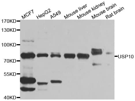Polyclonal Rabbit anti-Human USP10 Antibody (IHC, IF, WB)