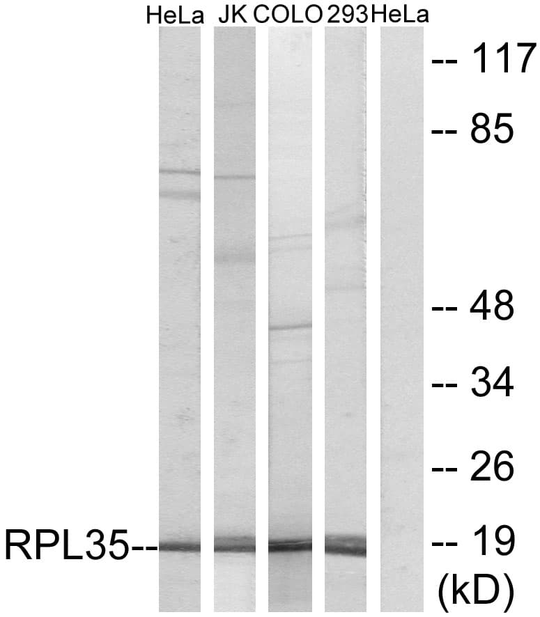 IHC-plus™ RPL35 / Ribosomal Protein L35 Antibody (aa51-100)