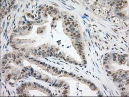 ERIC-1 / TACC3 Antibody (clone OTI8F6, Carrier-free)